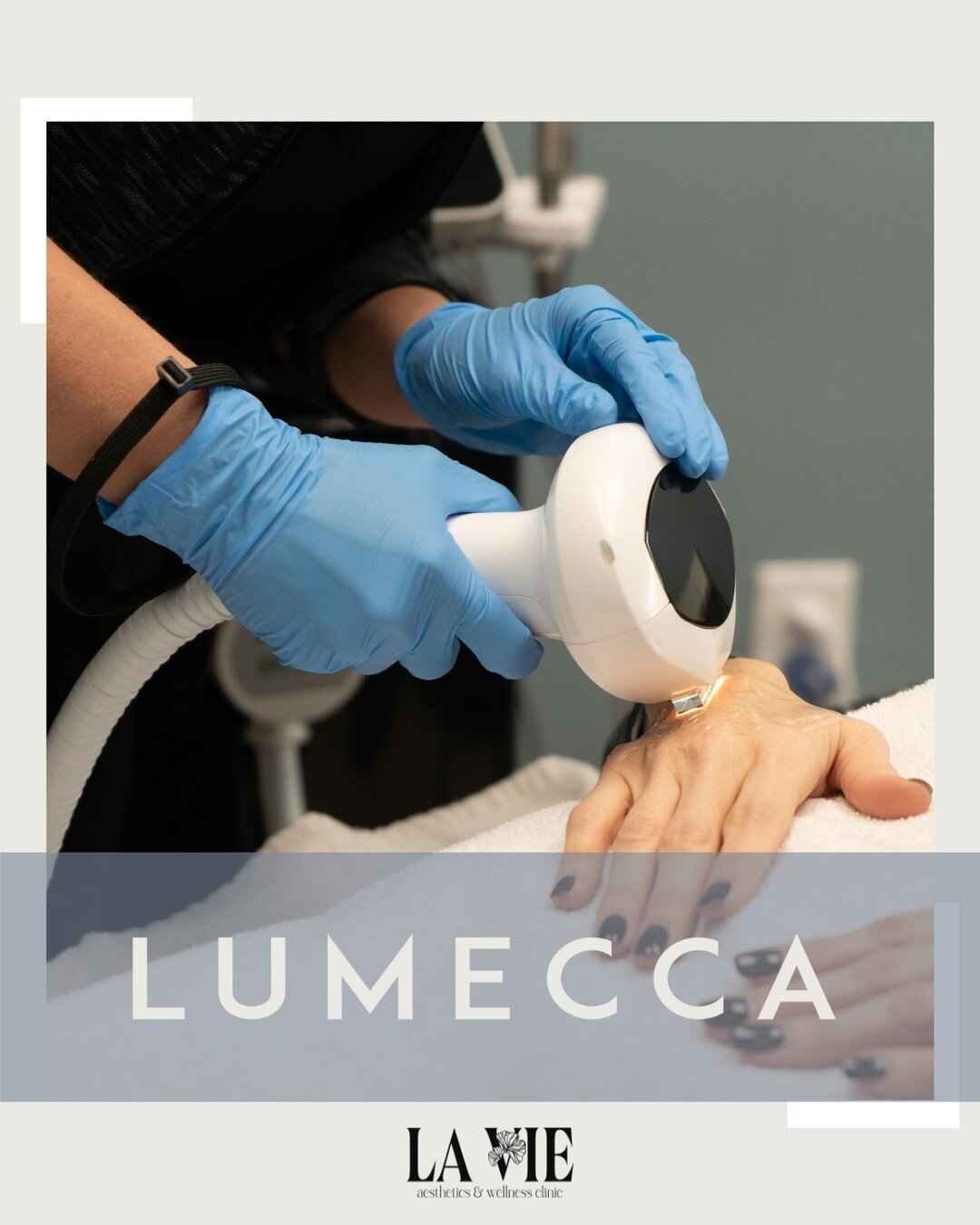 In just 1-3 sessions #Lumecca improves the appearance of:
 
 🌞Age spots (red/brown pigmentations)
 🌞Vascular lesions such as facial telangiectasias (spider veins)
 🌞Rosacea (redness)
 🌞Freckles
 🌞Sun damage
 
 Give us a call to learn more! 😊😊
