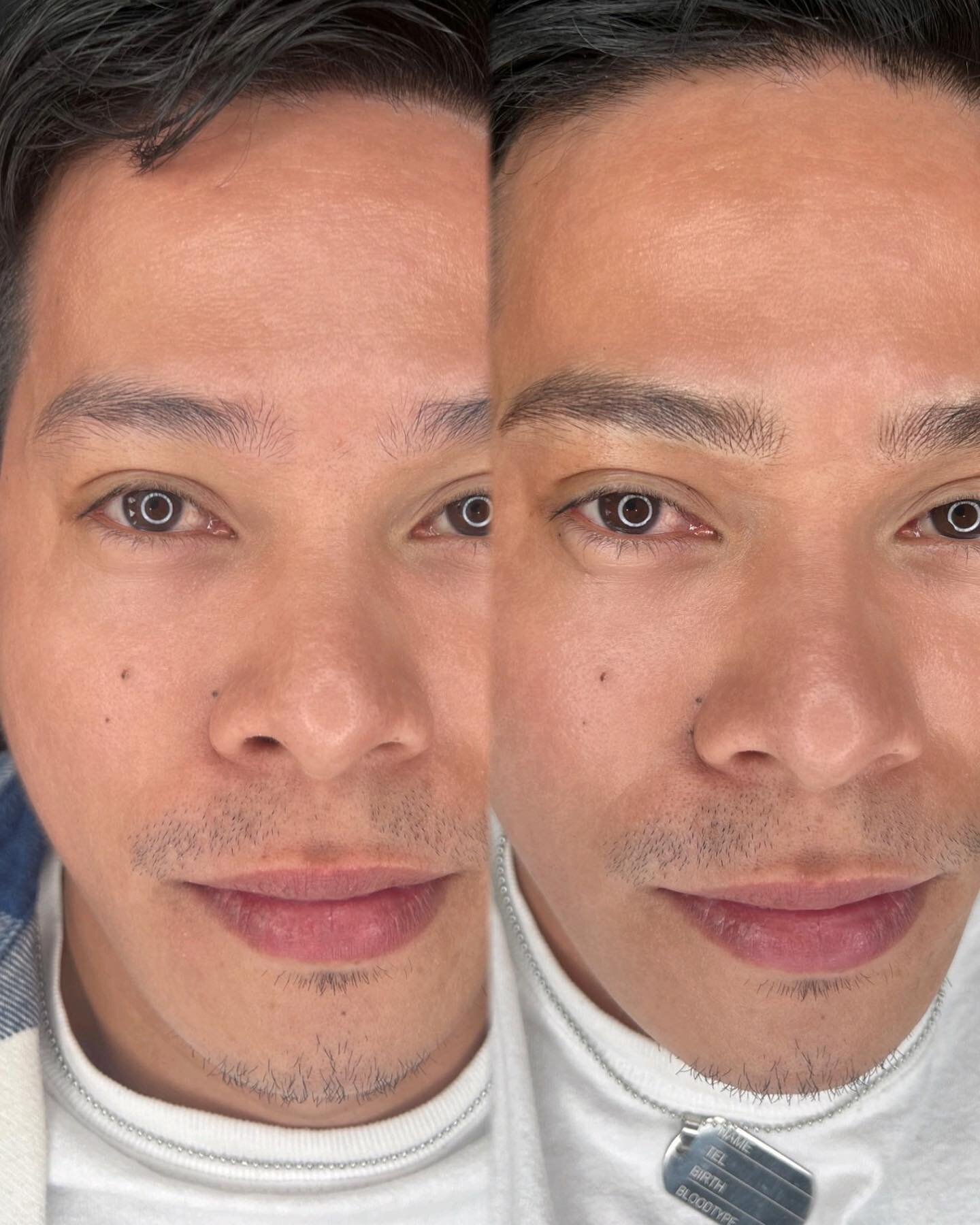 Enhance your brows with the magic of Nano-hairstrokes ✨

Subtle, natural, and empowering.

Say goodbye to sparse and shapeless brows! Discover the transformative effects of the Man Brow, boosting masculinity and enhancing your overall brow aesthetics