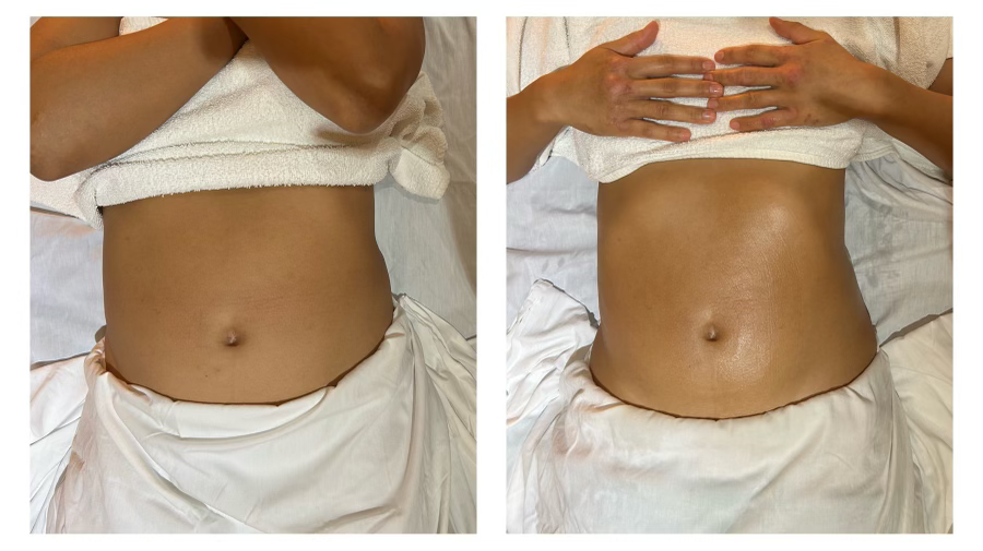 What Is Brazilian Lymphatic Drainage Massage Benefits Technique What Is Brazilian Lymphatic Drainage Massage Benefits Technique