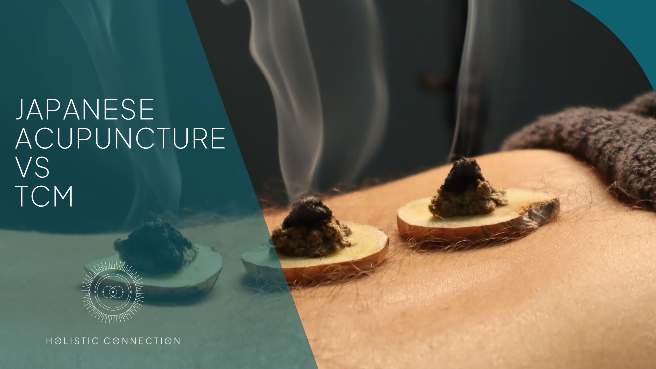 Japanese Acupuncture vs. Traditional Chinese Acupuncture: Key Differences Explained