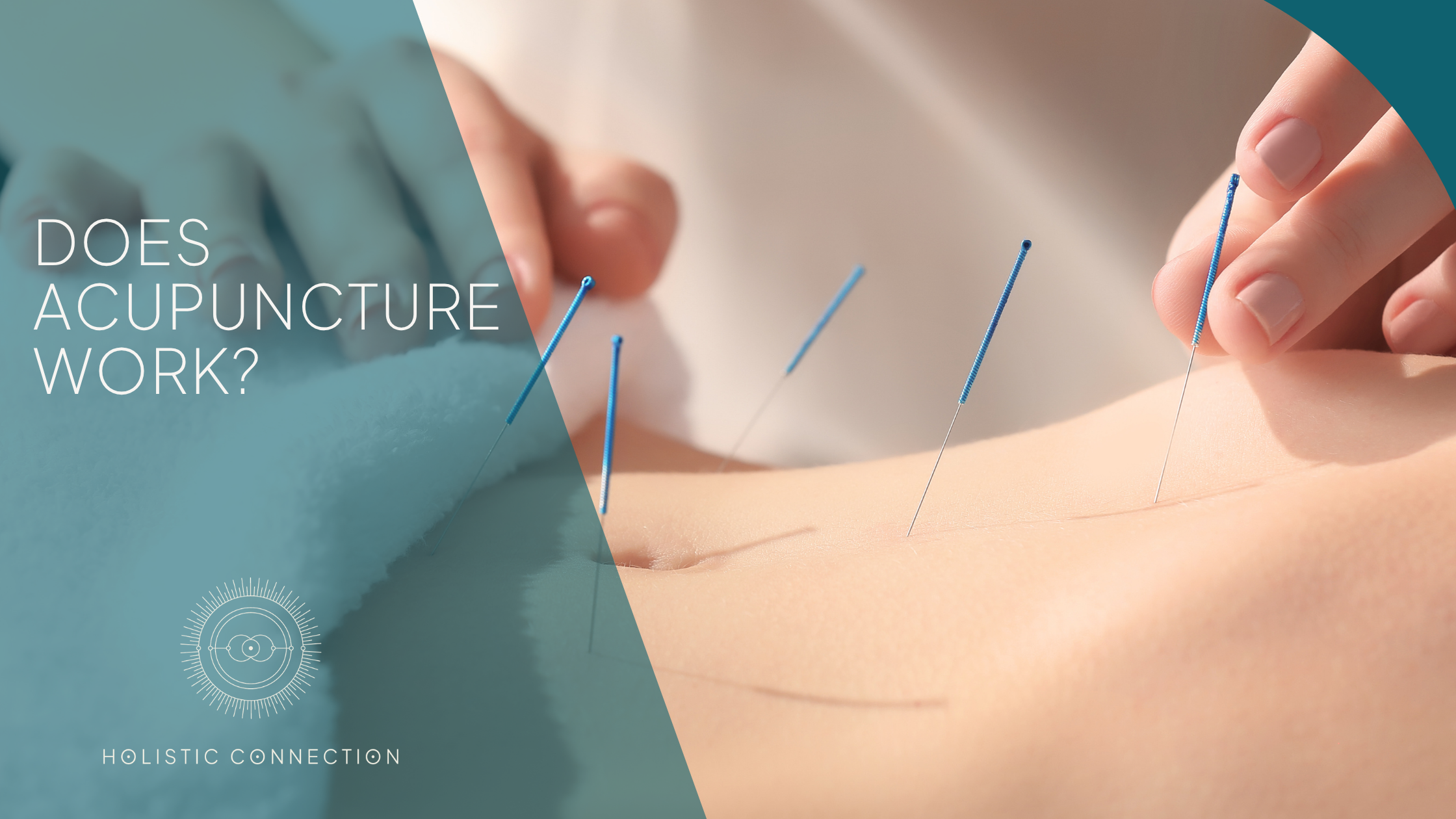 Does acupuncture work blog banner