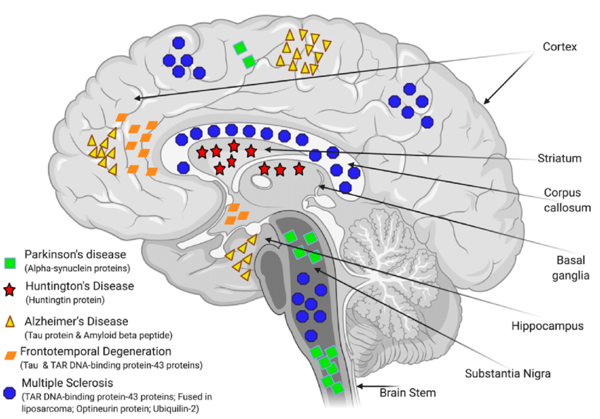 Is Energy Medicine a possible solution to offset the effects of neurodegeneration of aging?