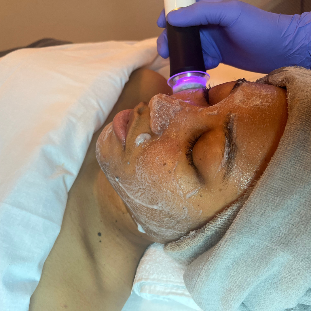 Professional facial killeen, tx