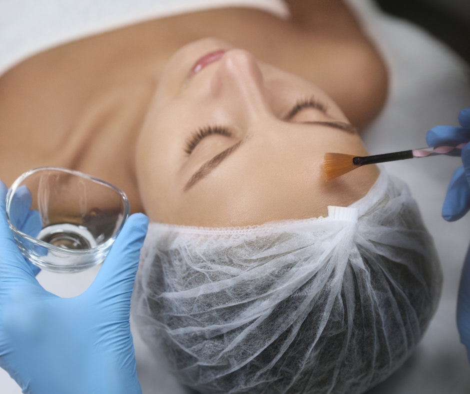 Chemical Peel Killeen, TX