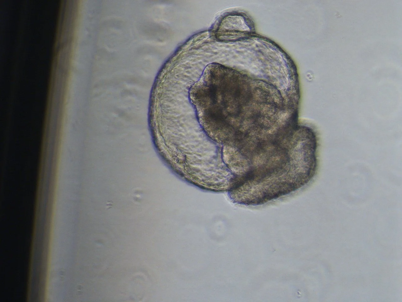 20230624_53LORLOAi9O_adCre_Infected_D14_10X_4bf.JPG