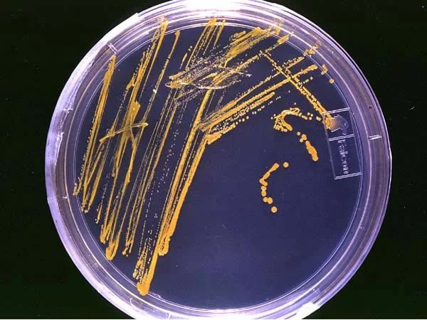 Agar_plate_with_colonies.jpg