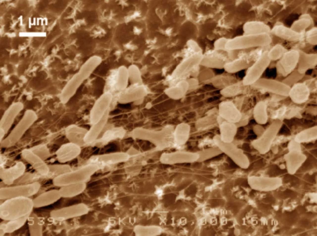 Eating the Inedible: Ideonella sakaiensis