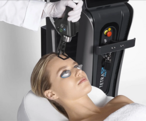 DEKA Pulse CO₂ Laser: Resurface to Reveal Radiance