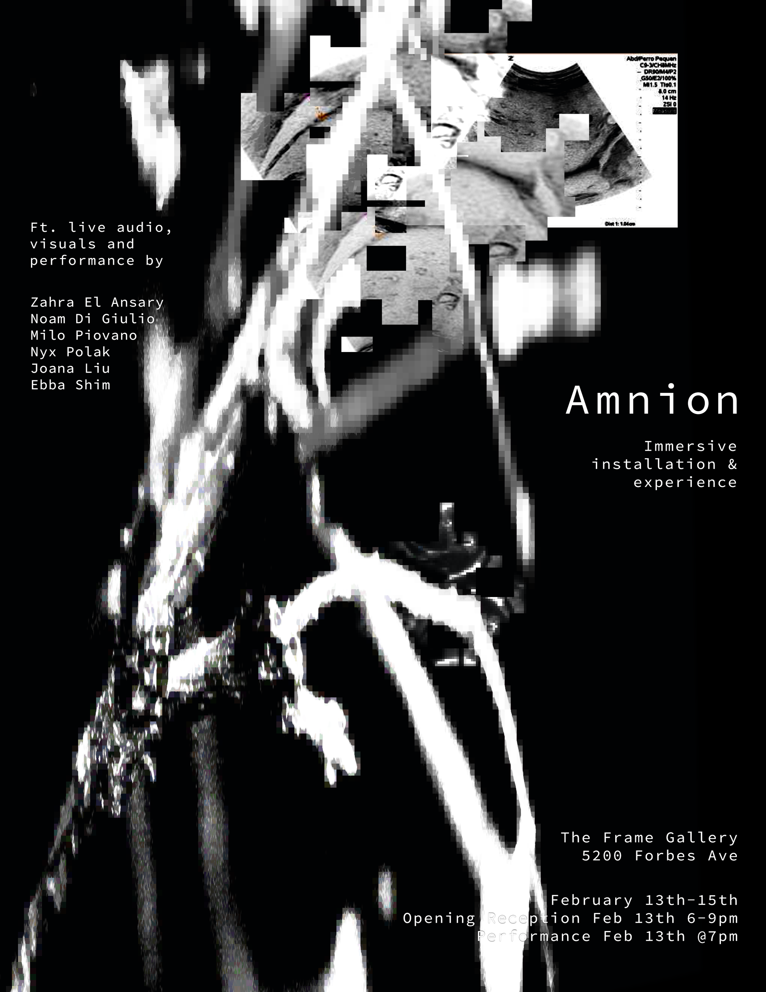 Amnion