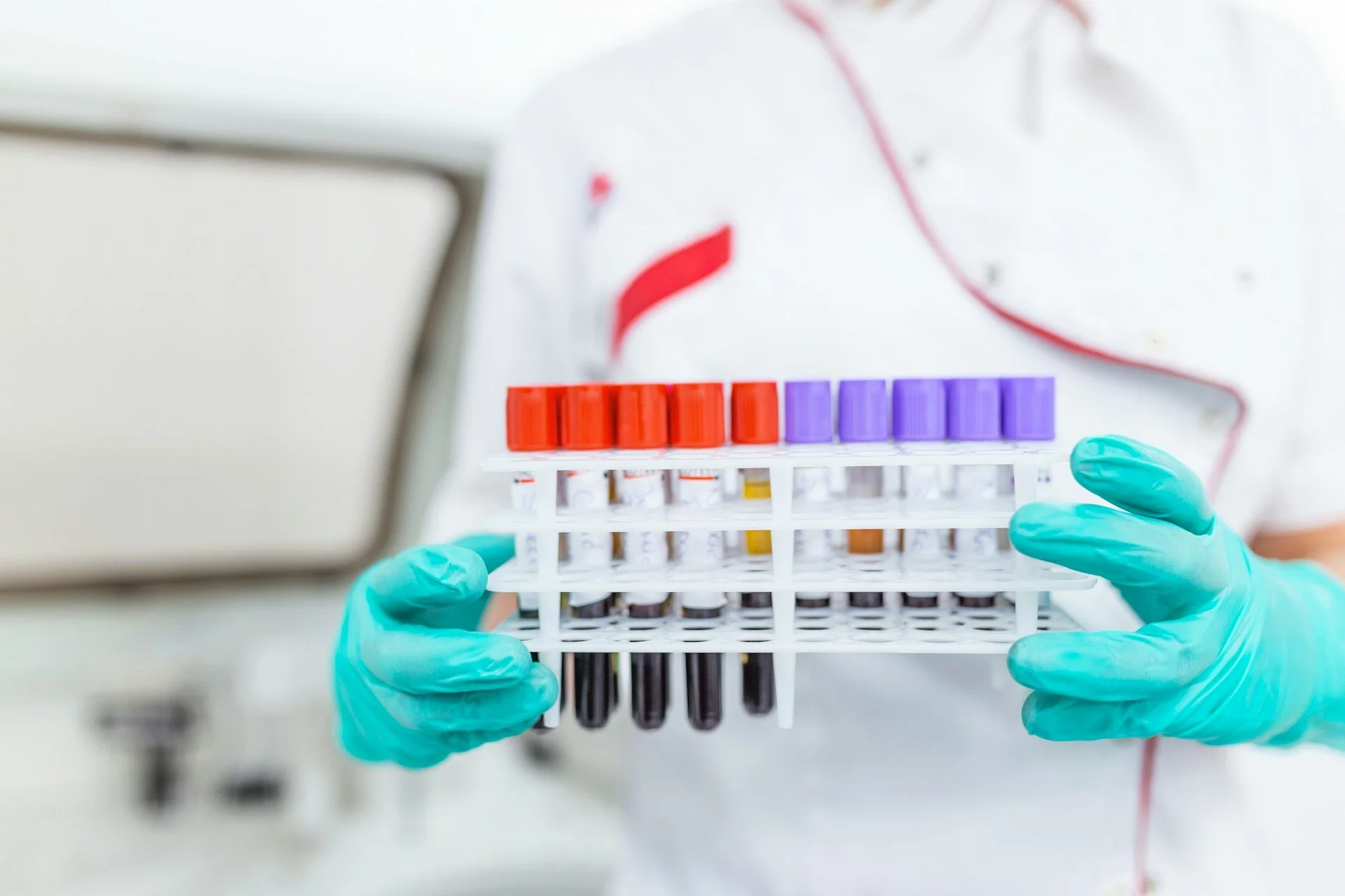 How a Testosterone Clinic in Toronto Handles Lab Tests