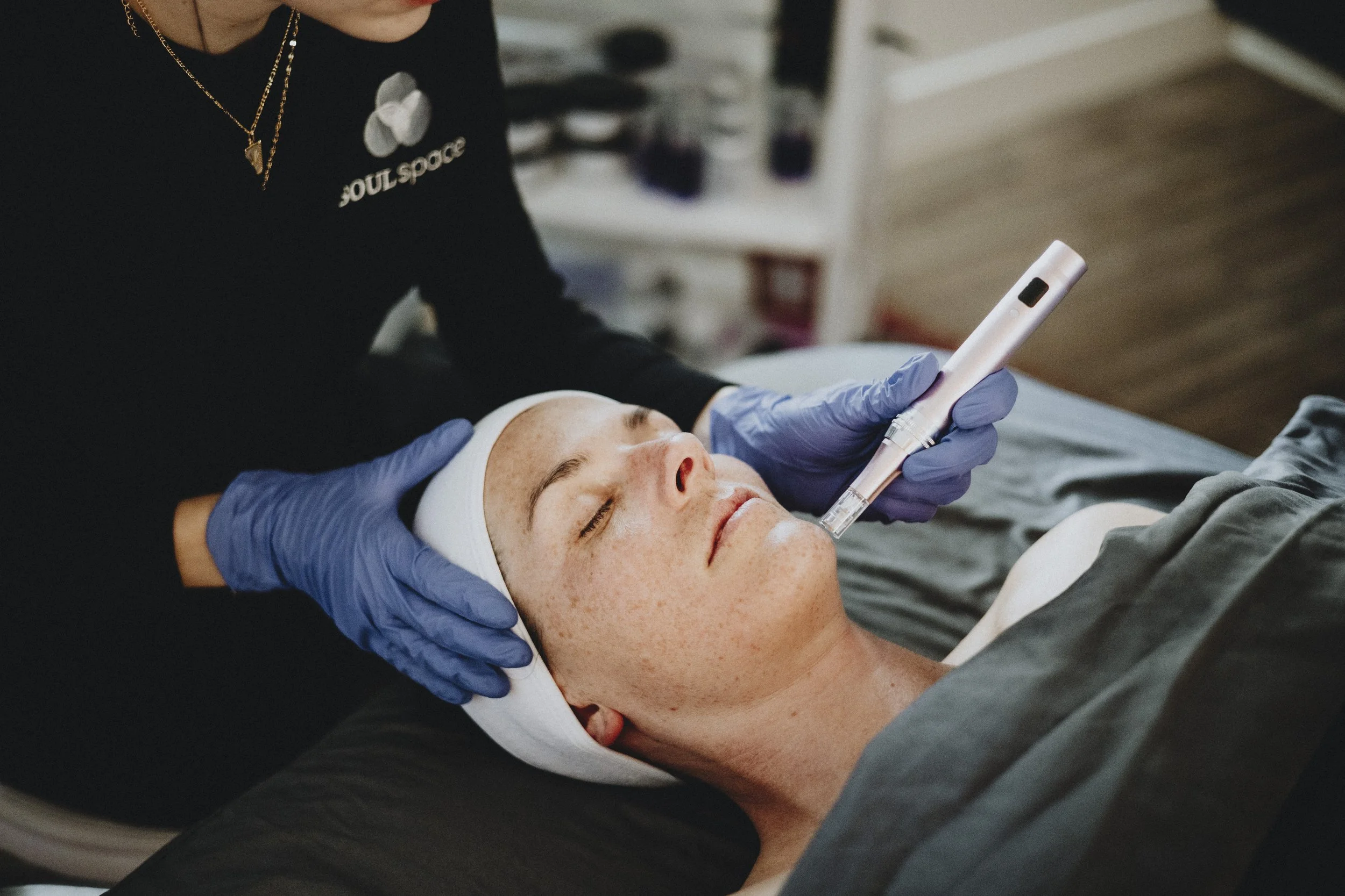 Microneedling Without the Med Spa: A Gentle, Restorative Approach to Skin Repair