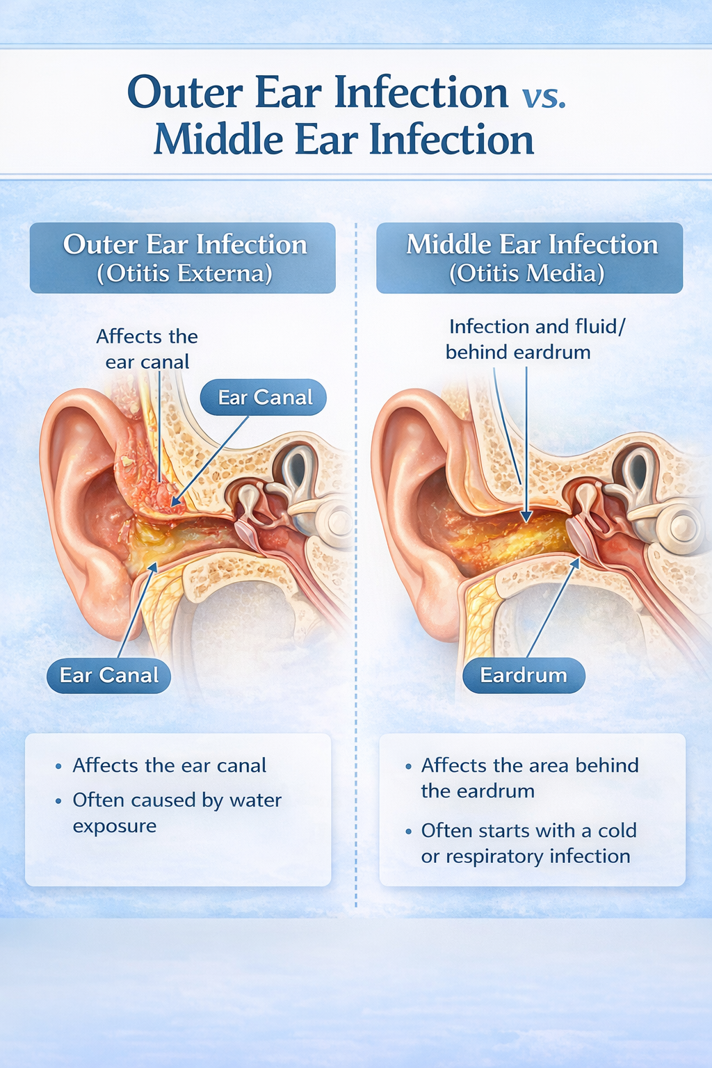 Swimmer’s Ear and Ear Infections in Bali: Travel Tips to Protect Your ...