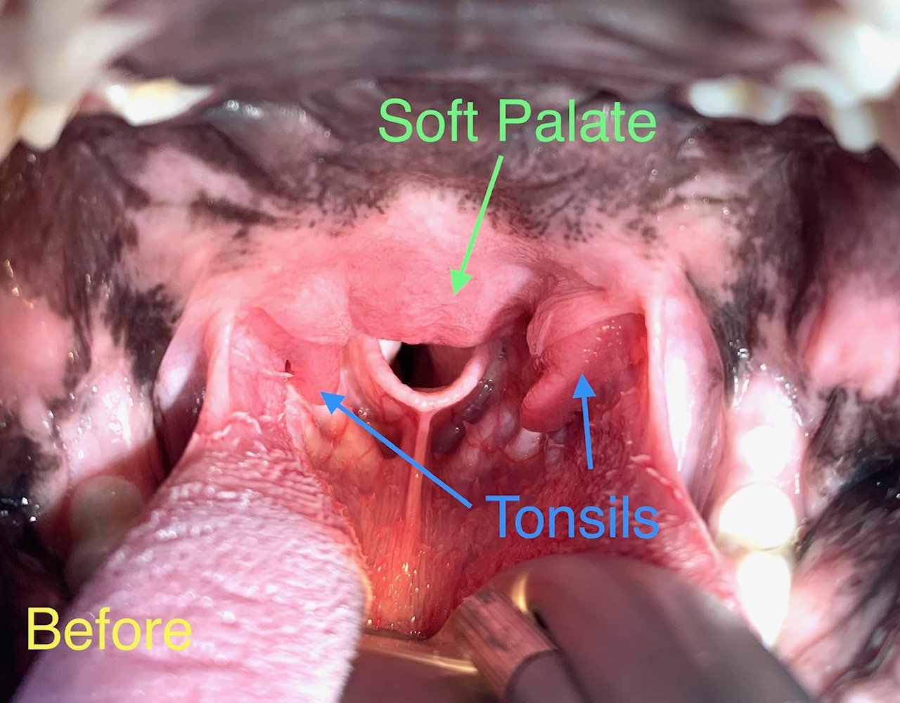 Oral Exam - Before surgery