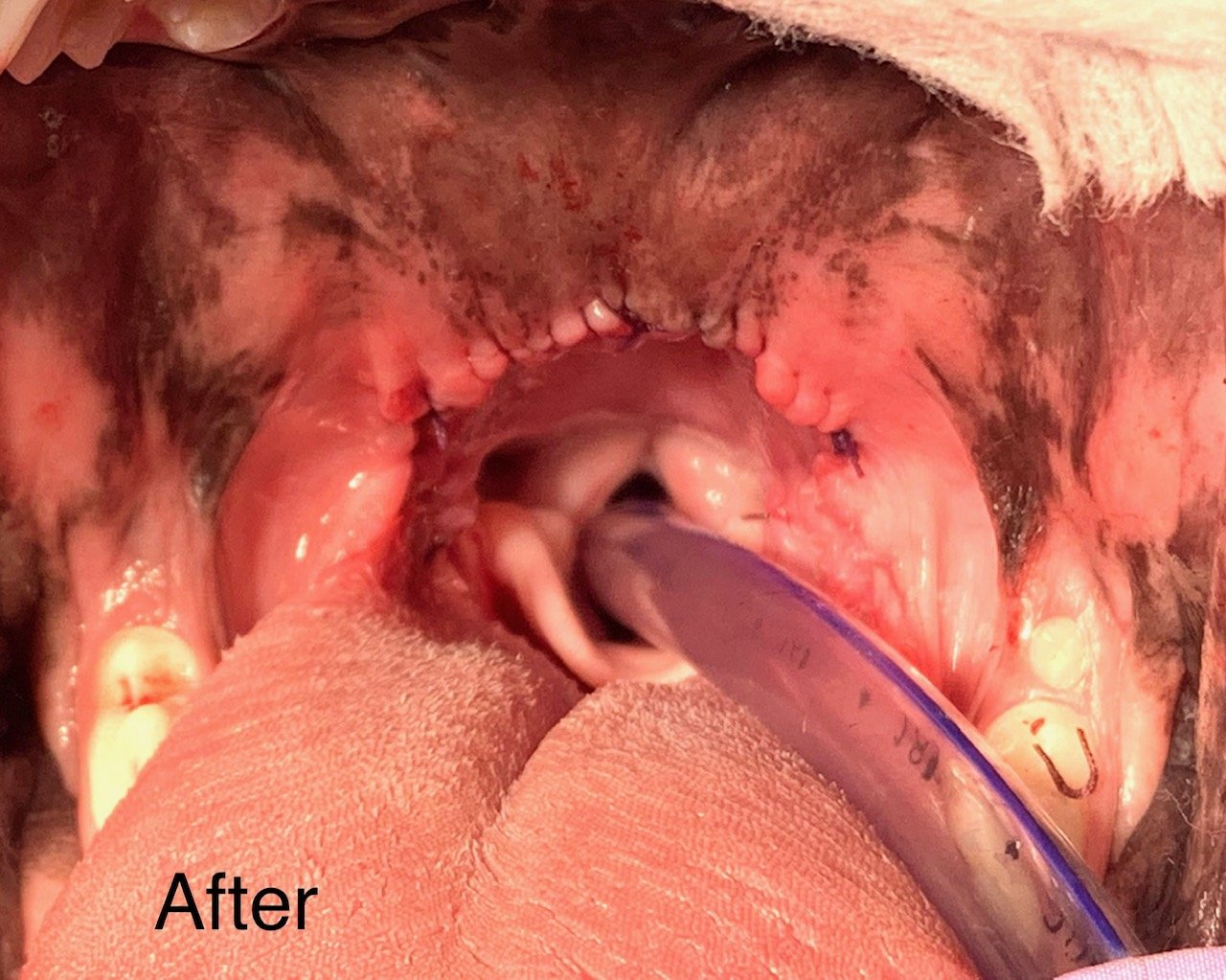 After Surgery - Folded Flap Palatoplasty & Tonsillectomy