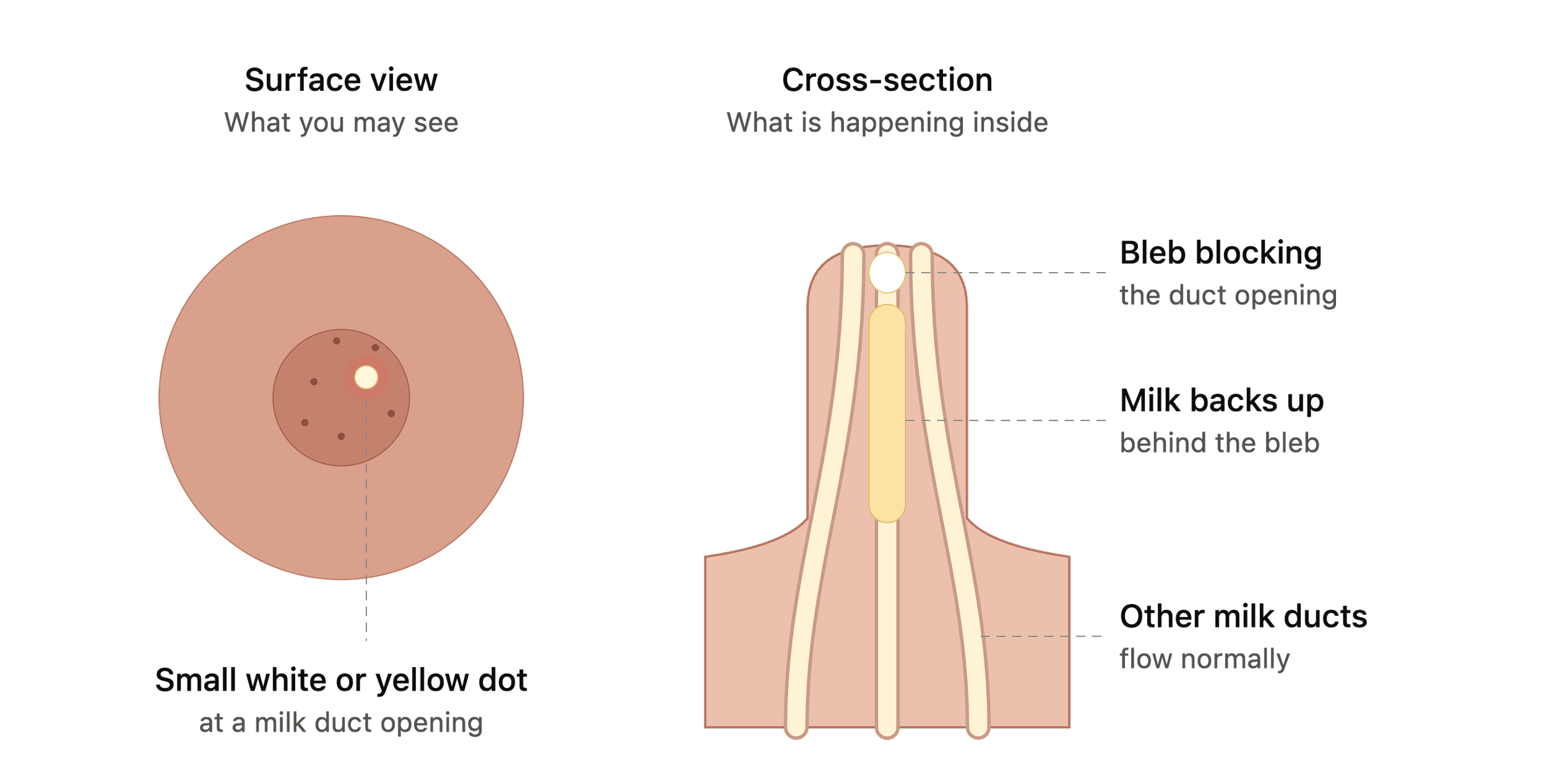 Common breastfeeding challenges singapore birth doula tips