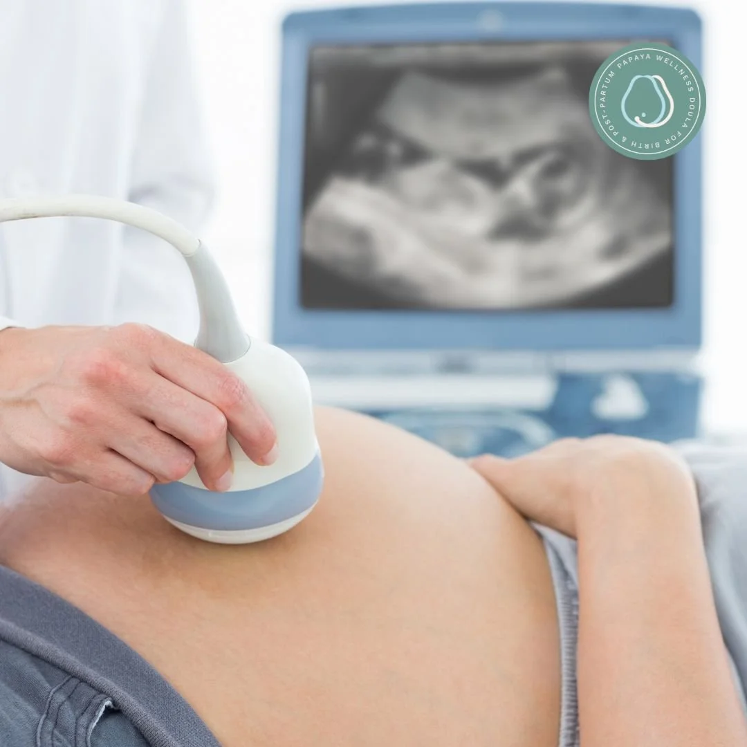 Choosing a Care Provider for you Birth in Singapore: Doula Insights &amp; Practical Tips