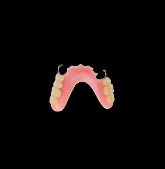 Acrylic Partial-BBG3-e.webp