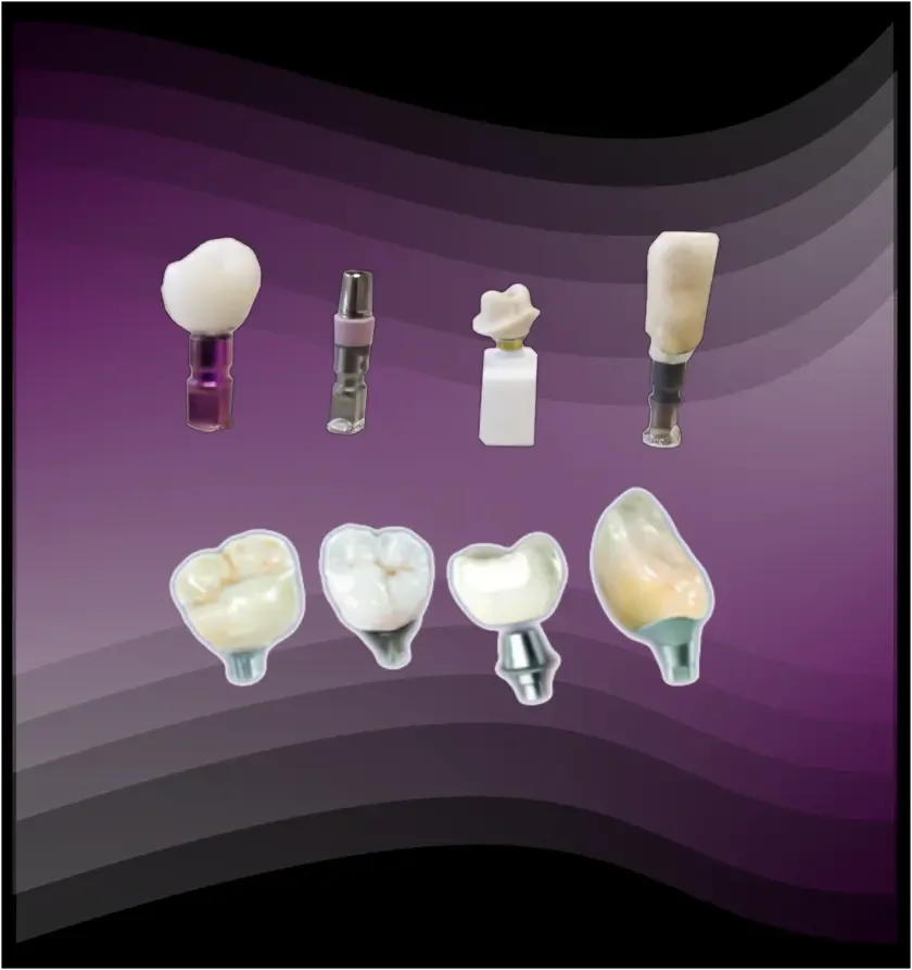 Custom Abutment by EDA-Esthetic Dental Art a Full-service Digital Dental Lab