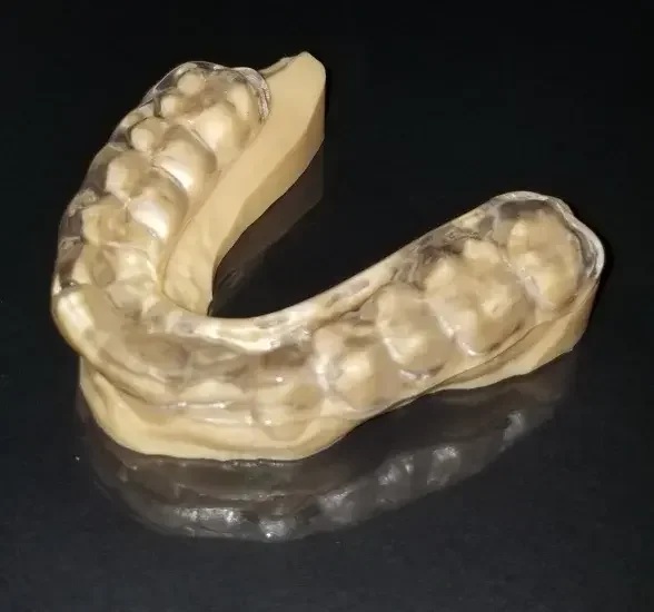 Custom Retainer by EDA-Esthetic Dental Art a Full-service Digital Dental Lab