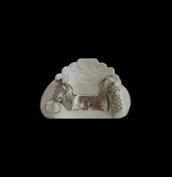 Cast-Metal-Framework-Only-Bilateral-272x182 (copy)-e.webp