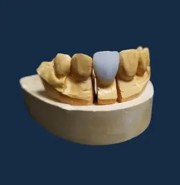 Zirconia dental crowns by EDA-Esthetic Dental Art a Full-service Digital Dental Lab