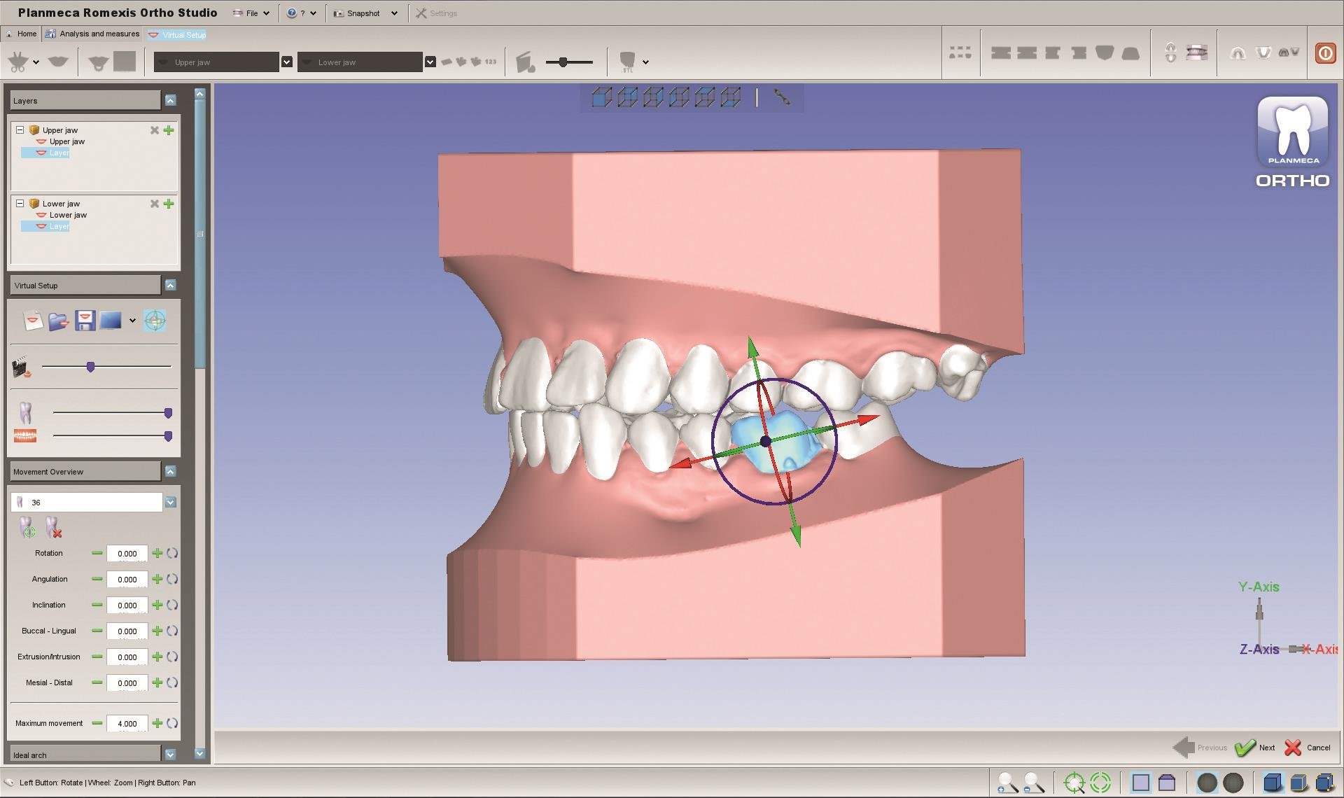 planmeca-introduces-new-3d-tools-for-orthodontists-and-dental-labs.jpg