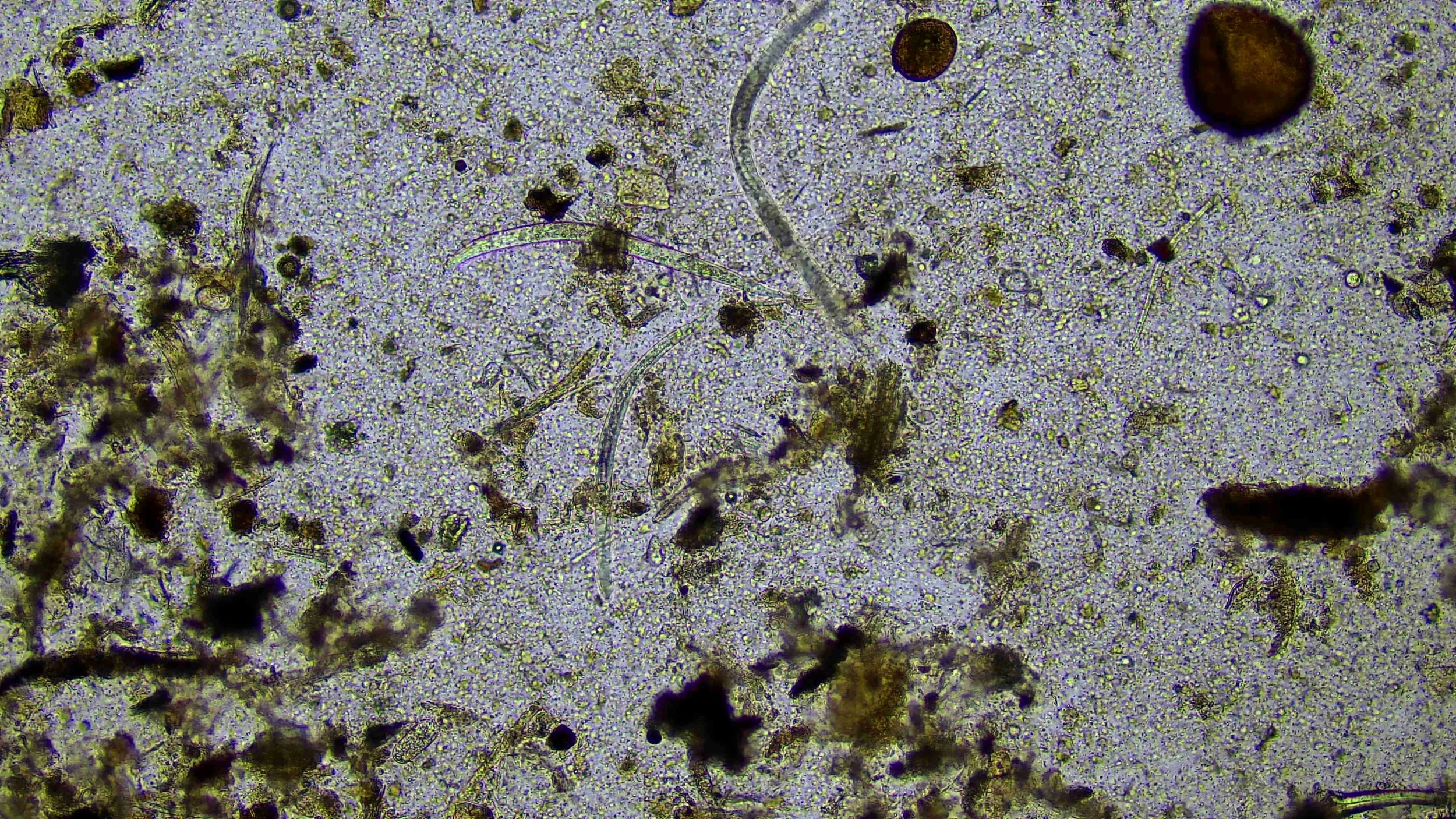 Compost extract under the microscope