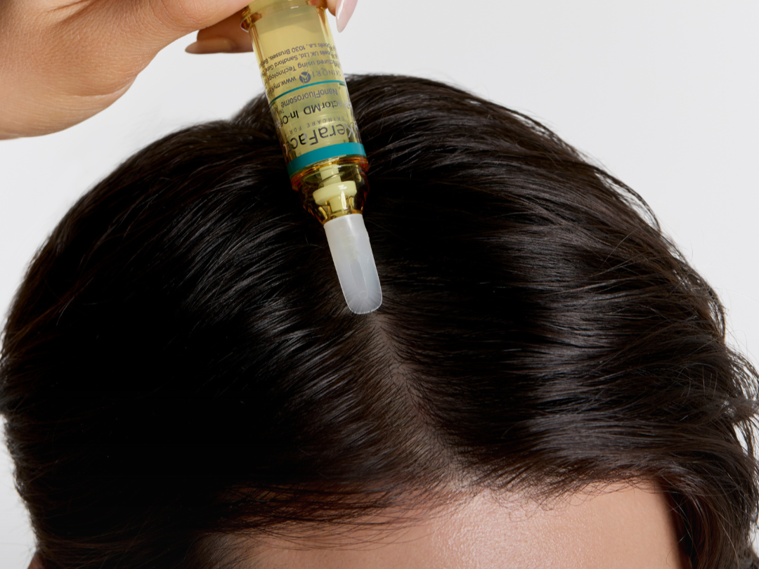 Advanced Hair Restoration with LaseMD Ultra Laser + Kerafactor