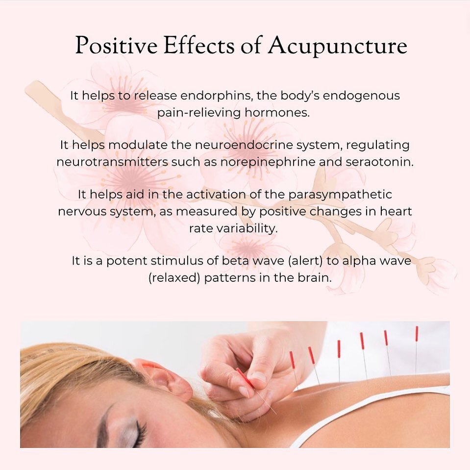 If you&rsquo;ve never had the opportunity to experience acupuncture, you may not know about all of the positive benefits it can bring to you.
The list above shows only a few of the good things acupuncture can do&mdash;there are so many more!
We will 