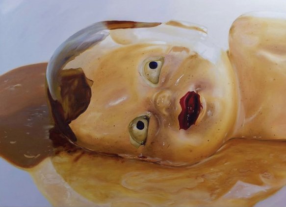  Emily Blair Quinn, "Biting Back" (2022)