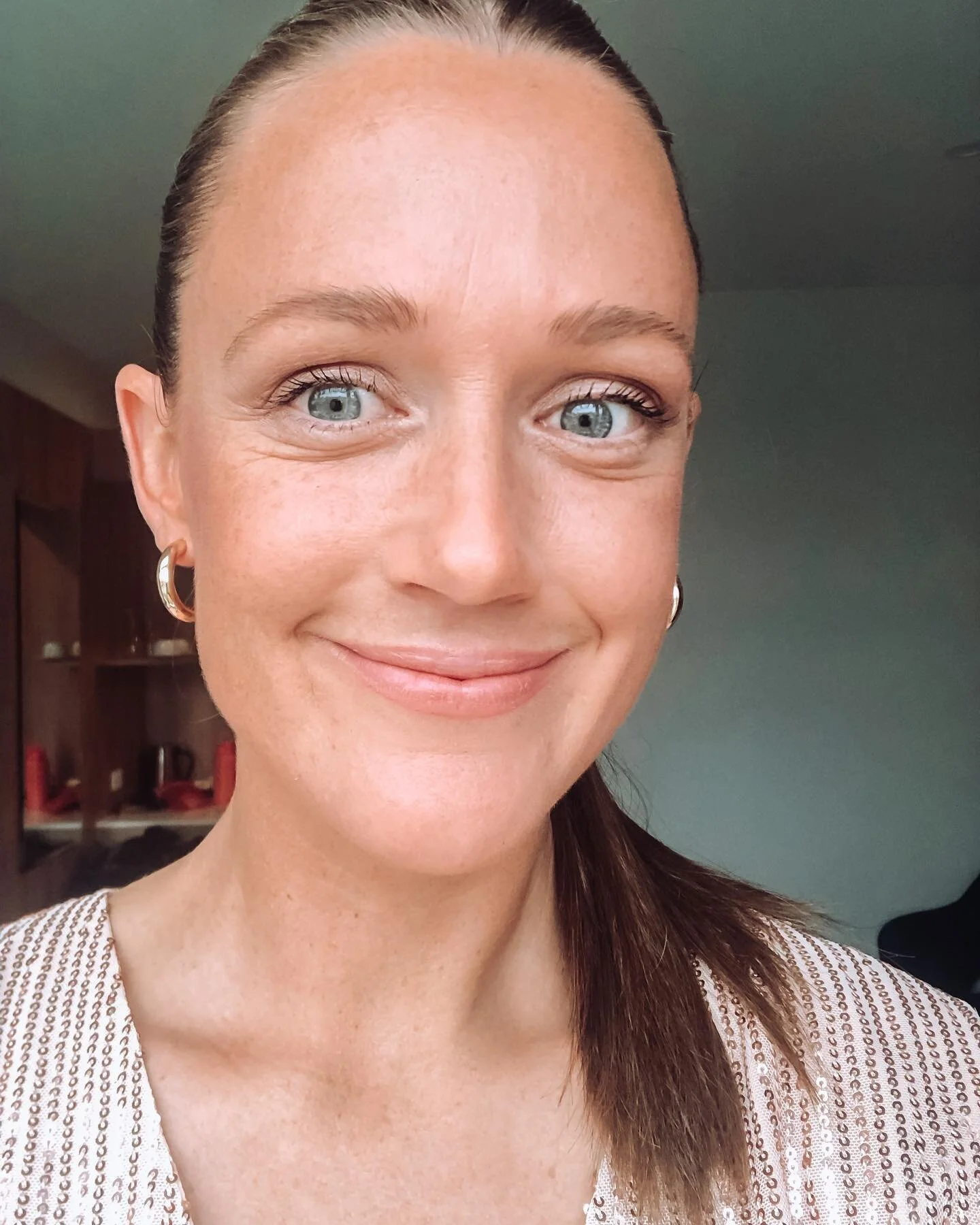 Friday night client spotlight 💞

This client is part way through an intensive treatment course of skin needling and chemical peels and is already seeing amazing results of smooth, glowing, refreshed skin. 
I cannot wait to see her results in 6 month