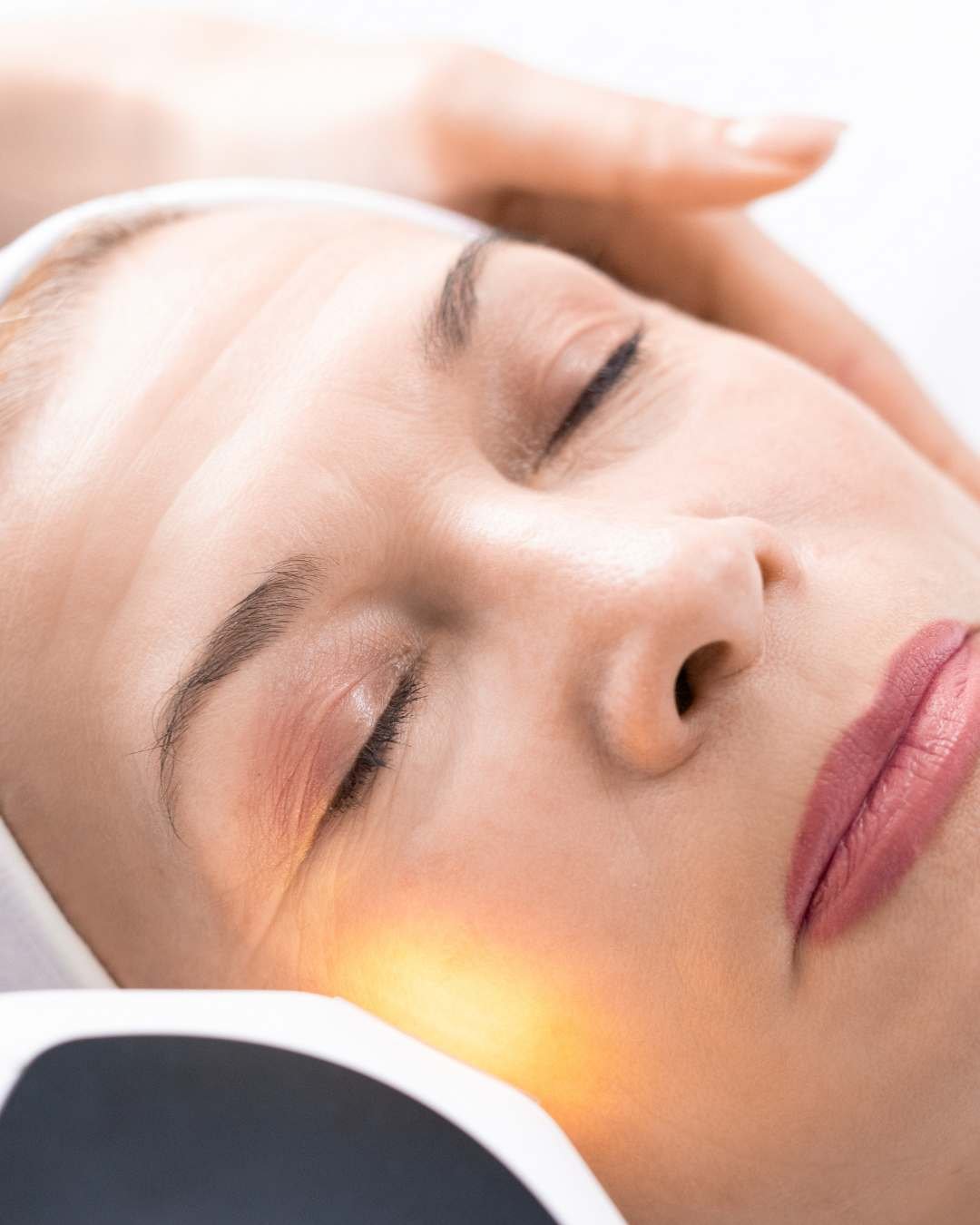 women having a tightening laser treatment