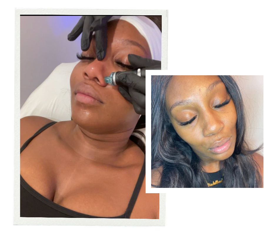 Fall Skincare: DIY at home Hydra Facial