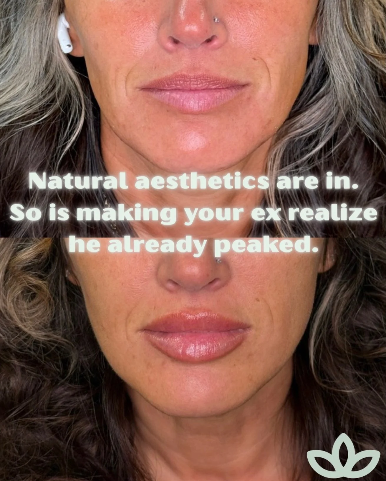 At this age, 90% of our patient&rsquo;s are not getting lip filler for the men. 💉 

They are getting lip filler because they have worked hard to have the ability to care for themselves, have fully developed frontal lobes for decision making, and nob