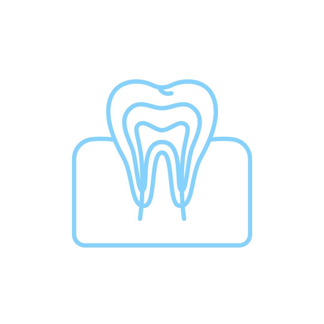 Root Canals