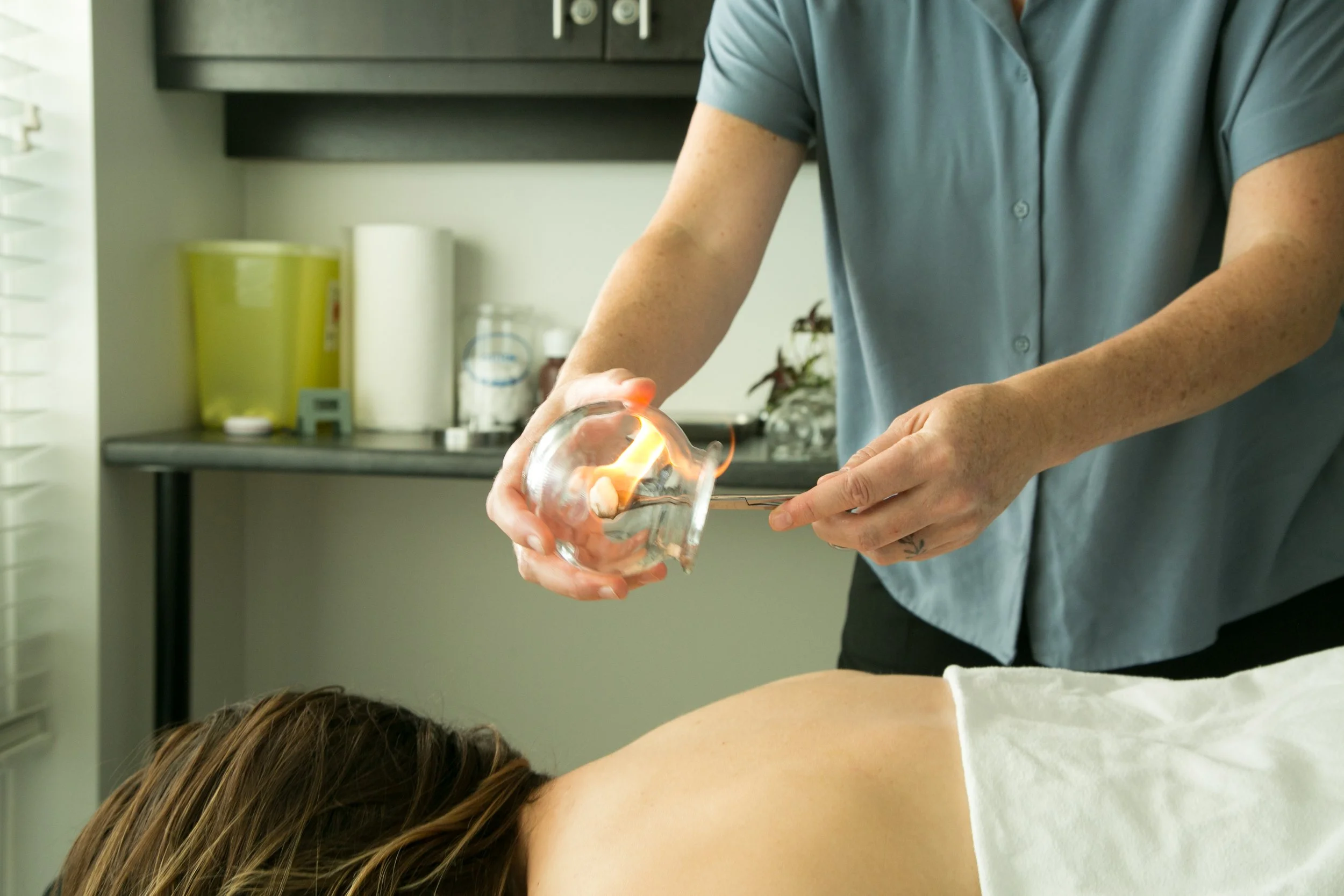 Person performing cupping therapy on a woman lying face down on a massage table.