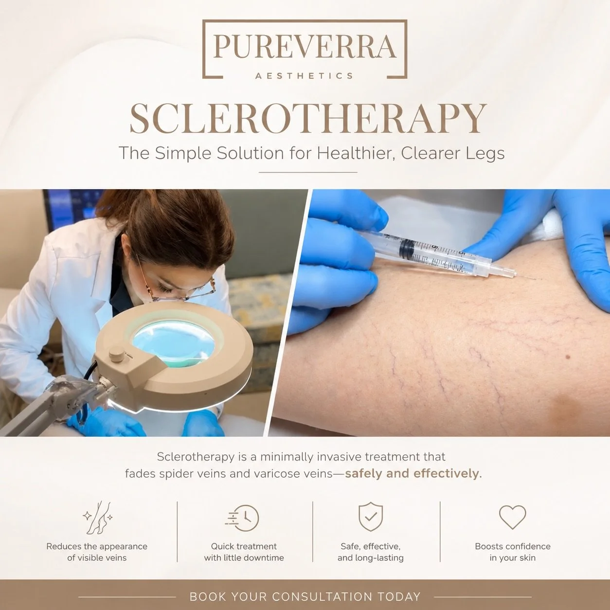 ✨ Say goodbye to spider veins and hello to smoother, clearer-looking skin ✨

Sclerotherapy is a quick, minimally invasive treatment designed to help reduce the appearance of spider veins and small varicose veins with little downtime 💉

At PureVerra 