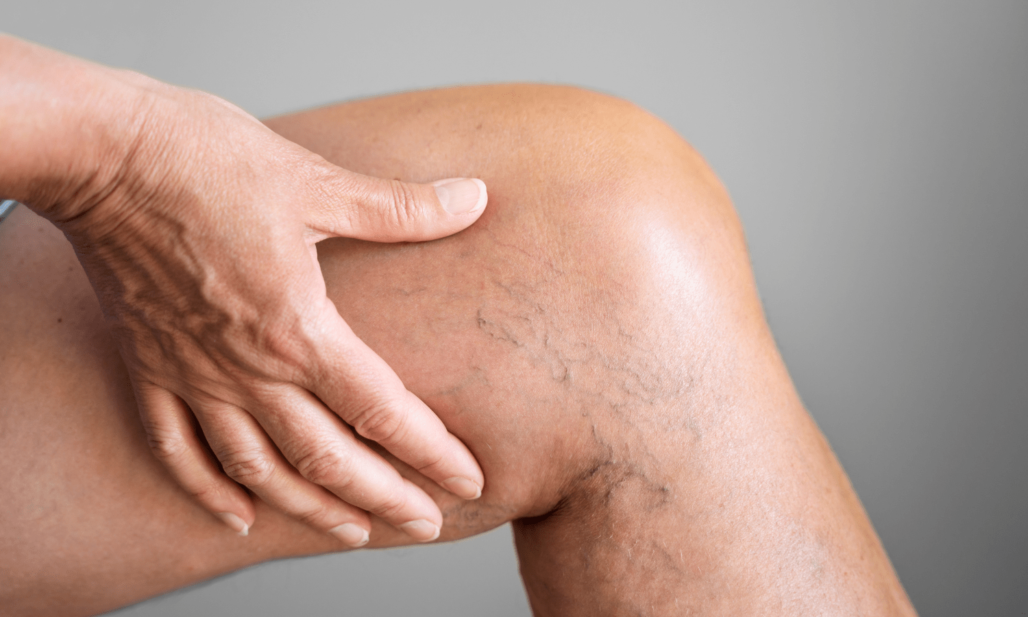 Could Your Leg Pain Be A Sign Of Vein Disease?