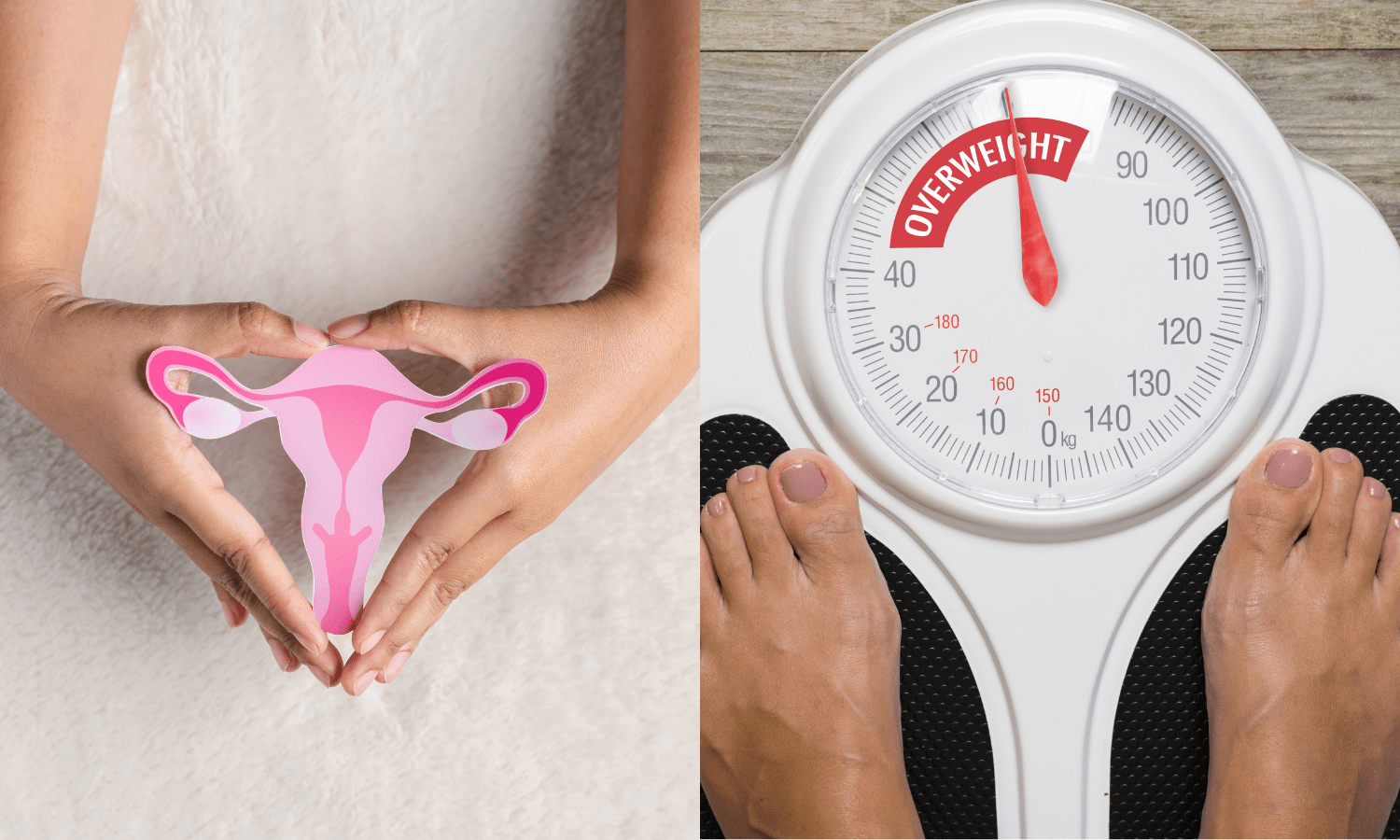 Two pictures highlighting weight scale and woman's feet, illustrating the connection between uterine fibroids and weight gain.