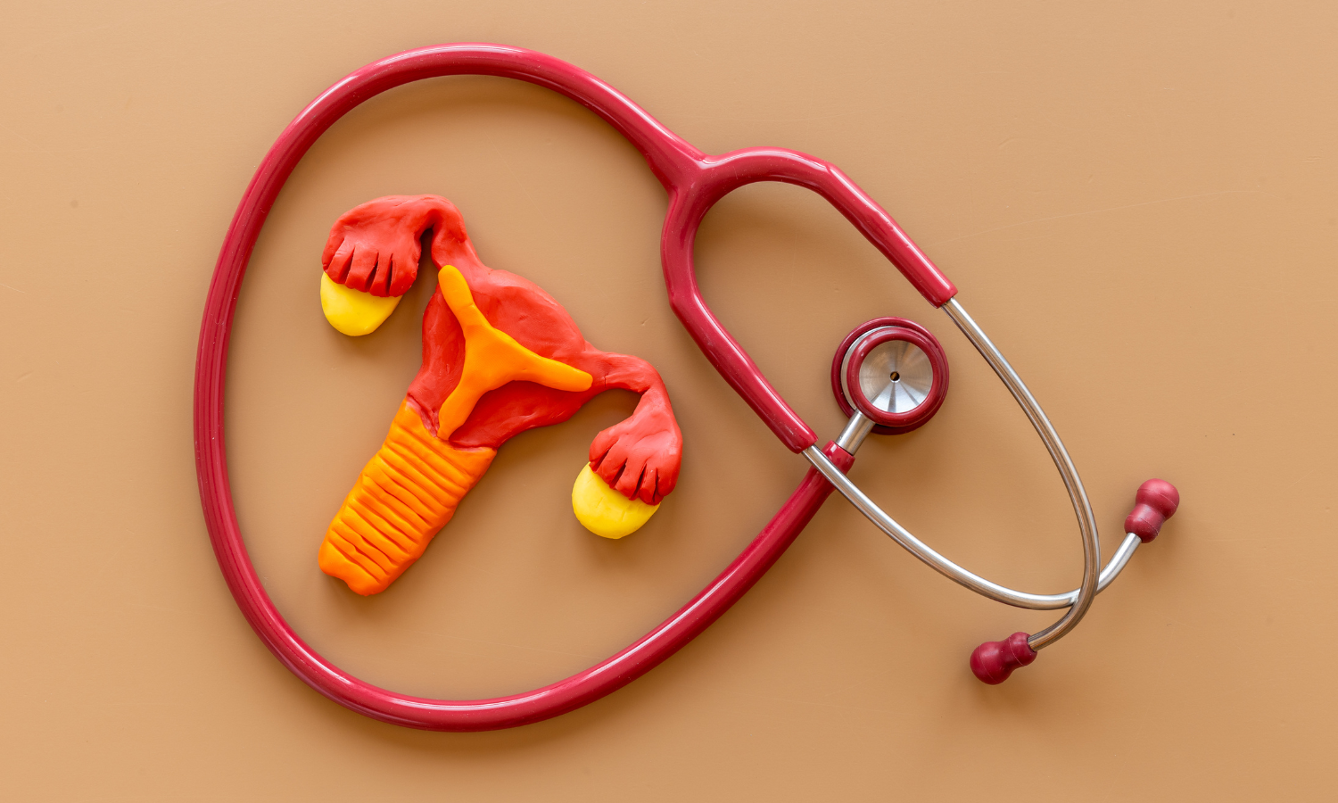 Uterine Artery Embolization vs. Uterine Fibroid Embolization