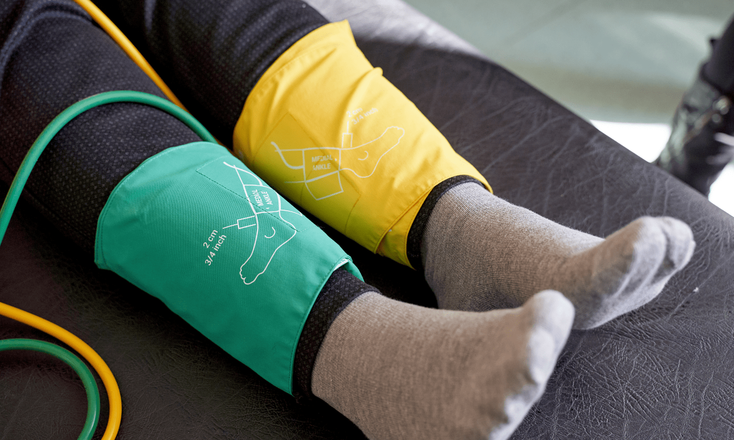 What Is An ABI Test?