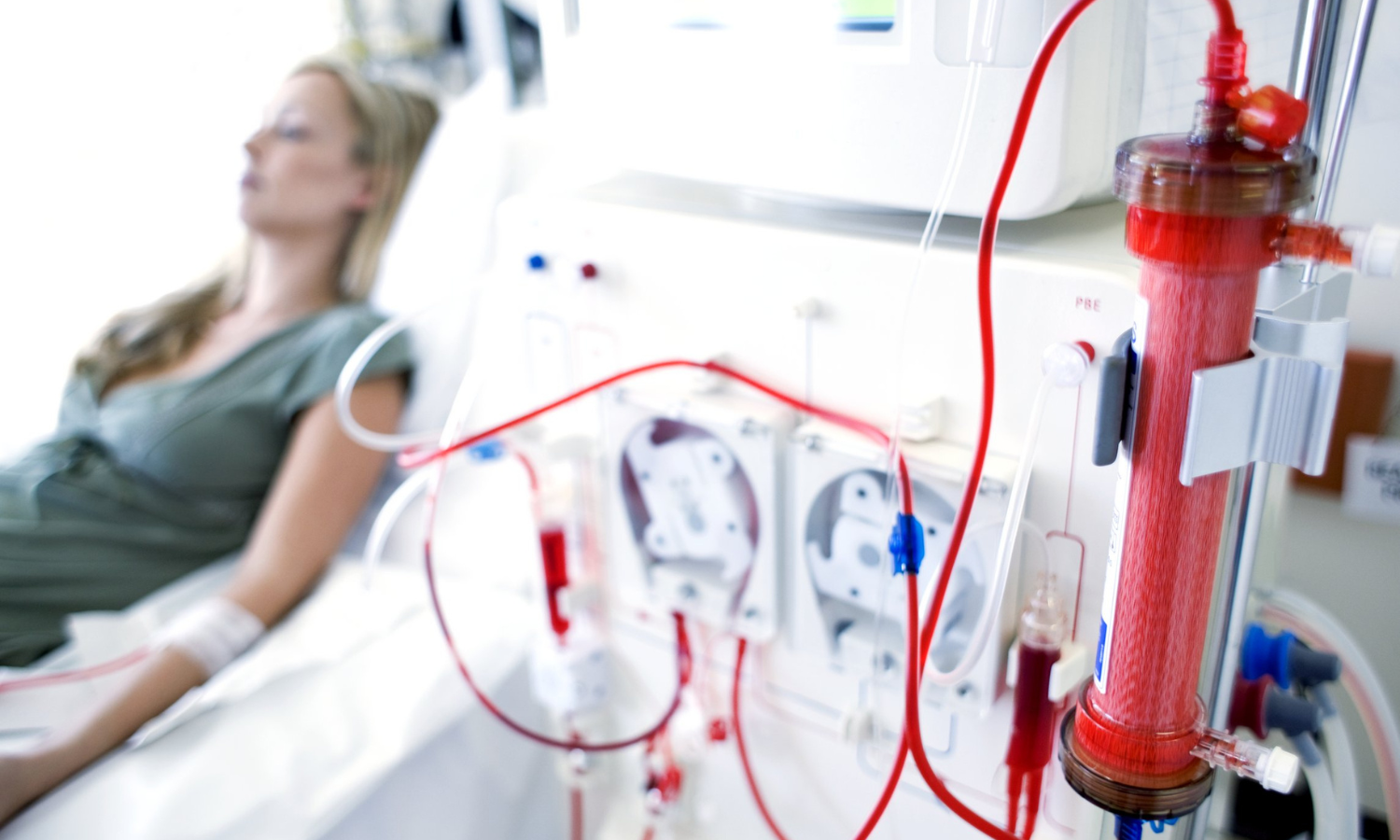 Outpatient vs Home Dialysis Treatment