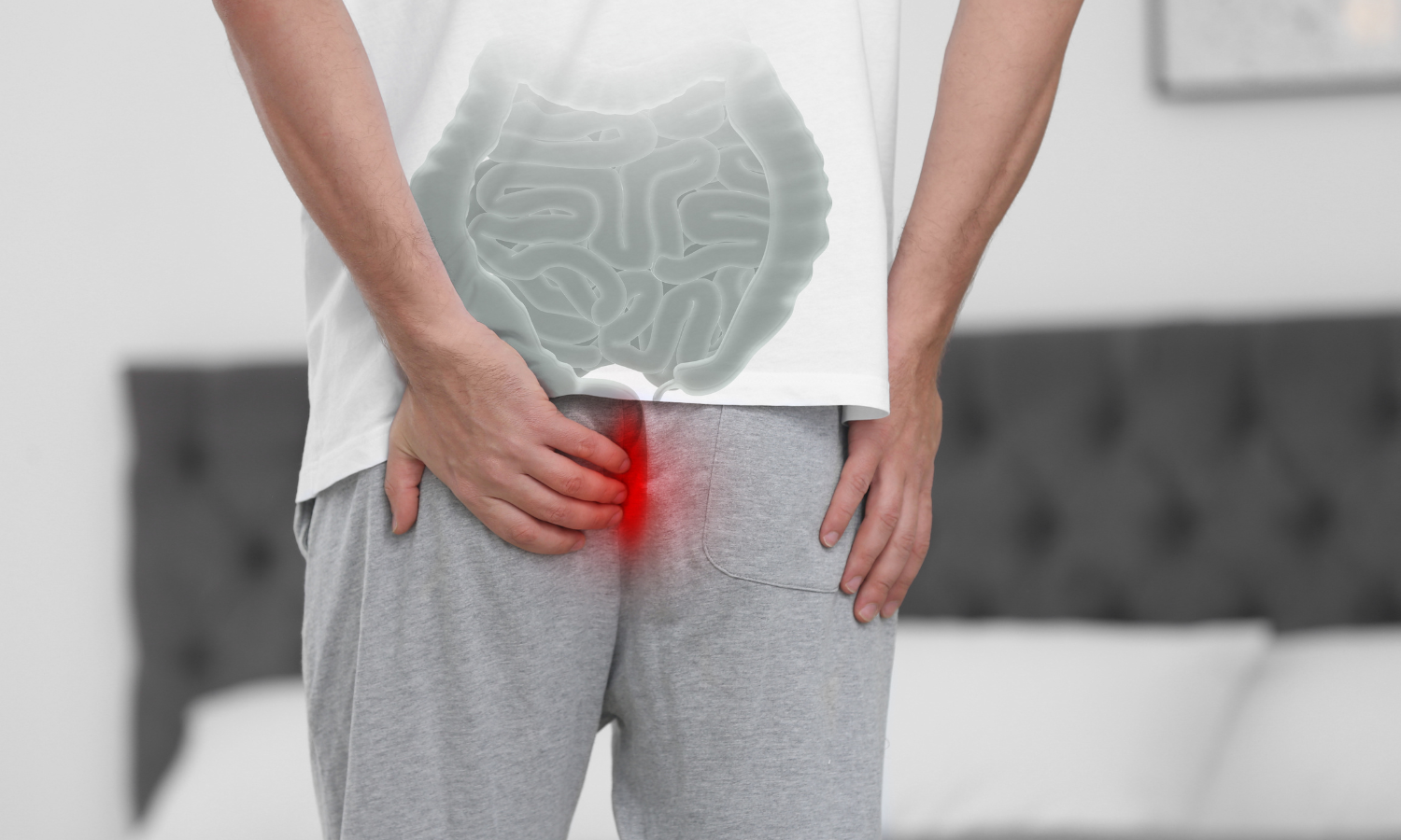 How To Prevent Hemorrhoids?