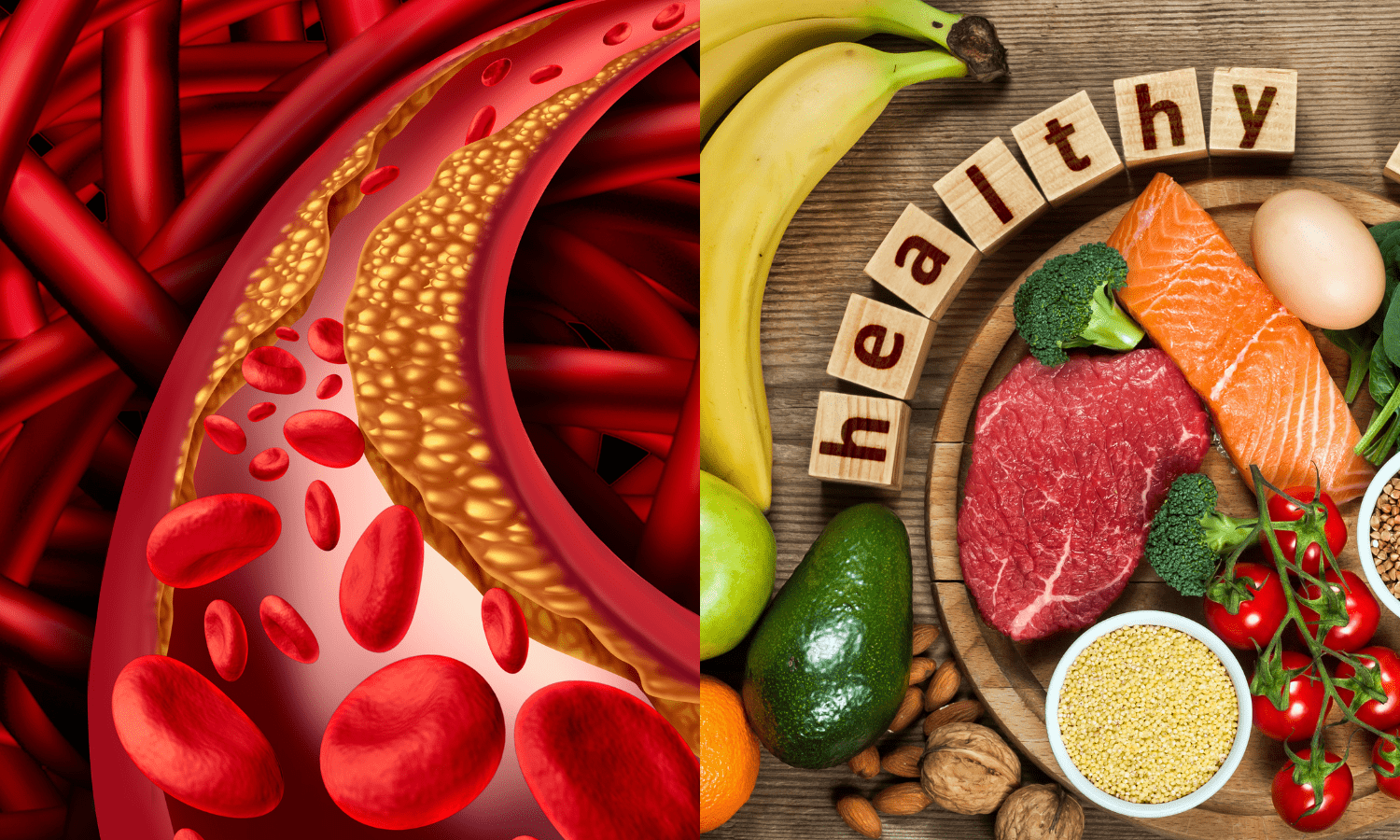 A visual representation of the optimal diet for Peripheral Arterial Disease featuring nutritional foods and a blood vessel.