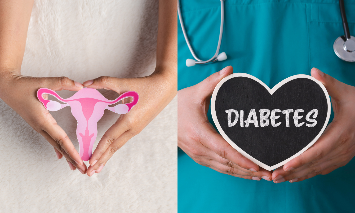 Is There a Connection Between Uterine Fibroids and Diabetes?
