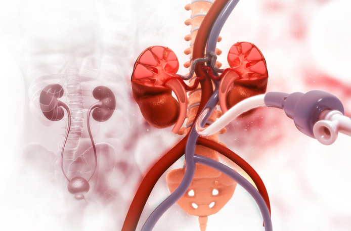 Renal Artery Stenting