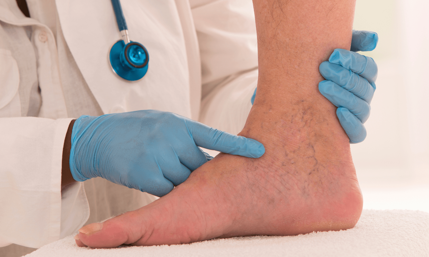 Causes of Critical Limb Ischemia