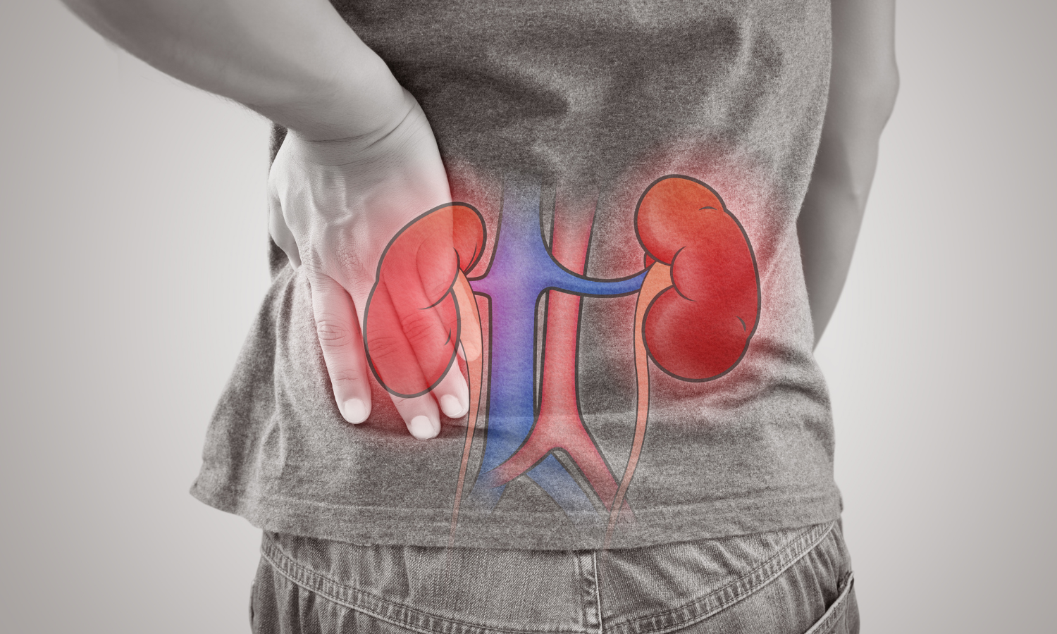 Importance of Diagnosing Renal Artery Stenosis