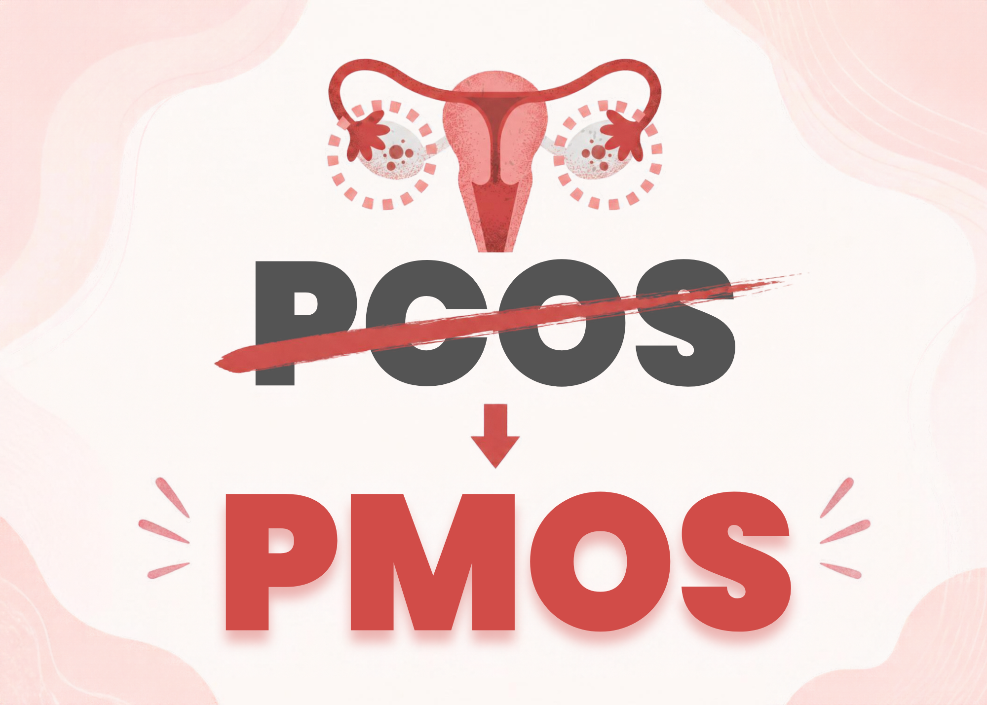 PCOS is Now PMOS: What the Name Change Means for You