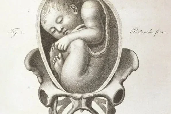 The Caesarean Scar Niche: What Every Woman Who’s Had a C-Section Should Know